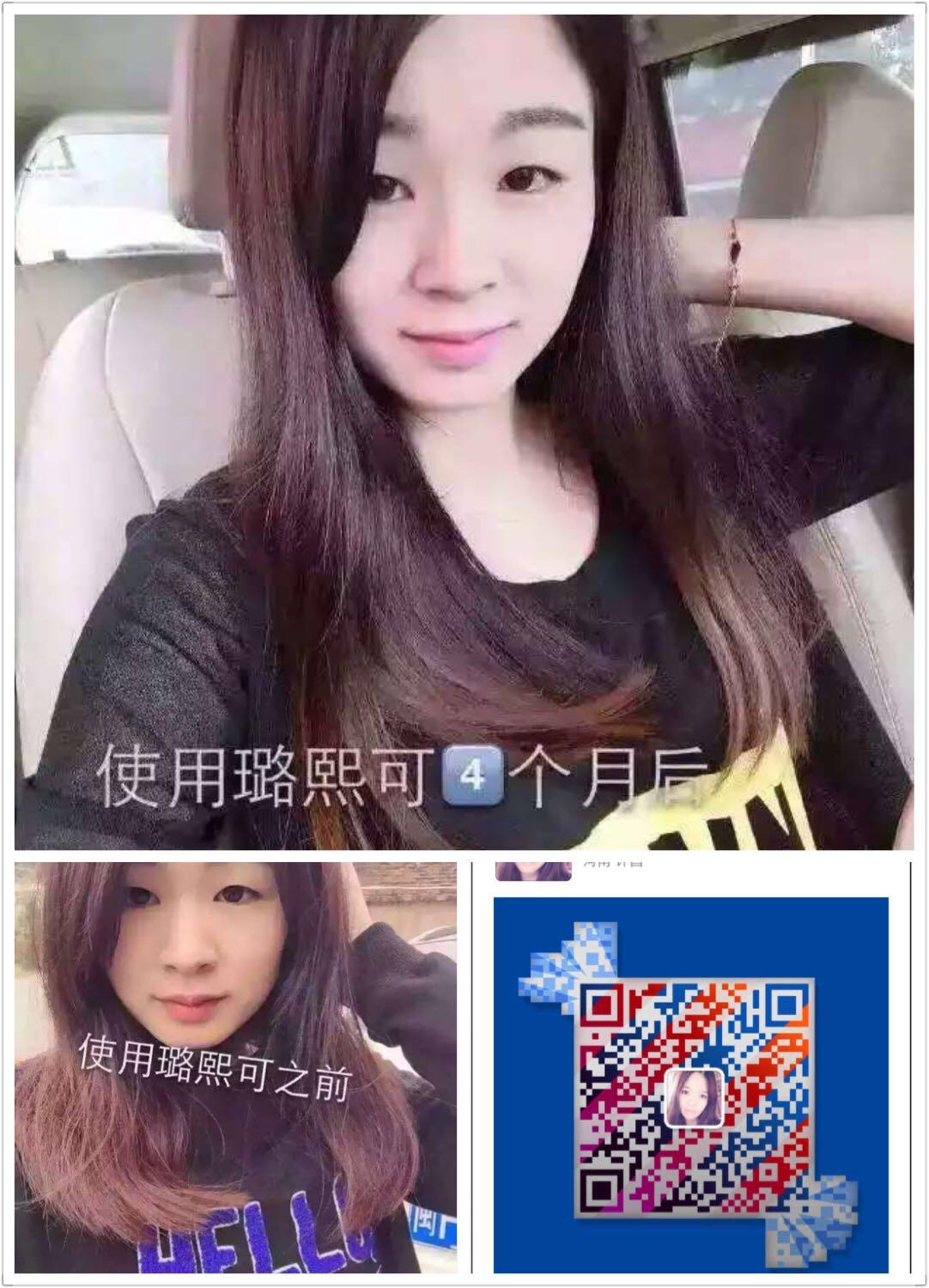 冬天<em>头发干枯</em>焦黄<em>打结怎么办</em>? - 果果的回答 - 