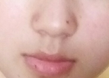 左鼻翼和左耳以及右下嘴唇上各有一颗痣,请问这是善痣