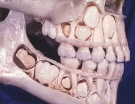 为什么智齿在人体基本发育成熟后才萌发?