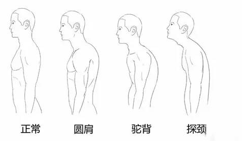 不想继续弯腰驼背?到这儿来!