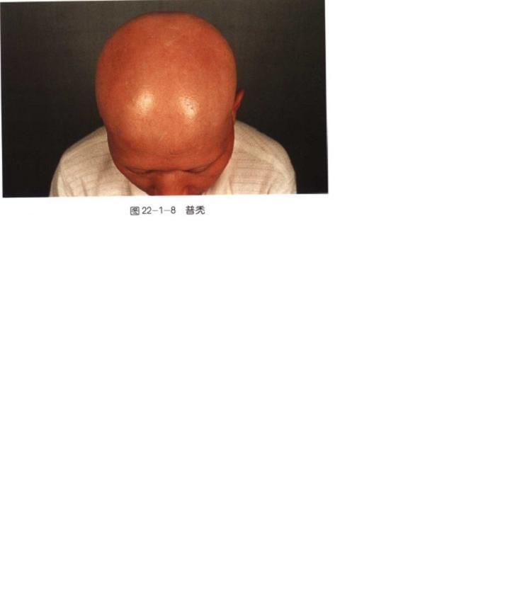 <em>为什么男人</em>不脱胡子却<em>脱头发</em>? - 医学 - 知乎