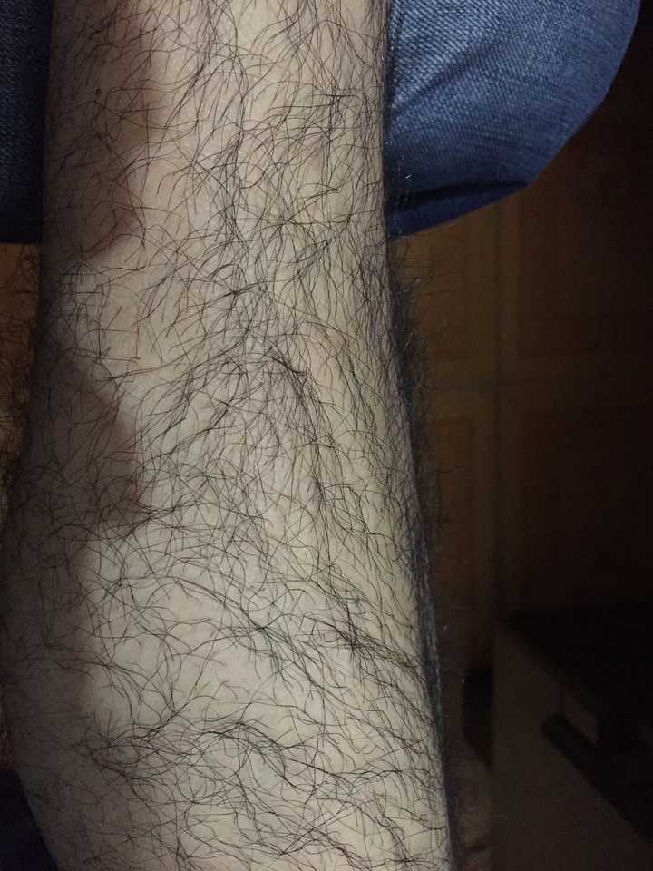 男生怎么打理腿毛?