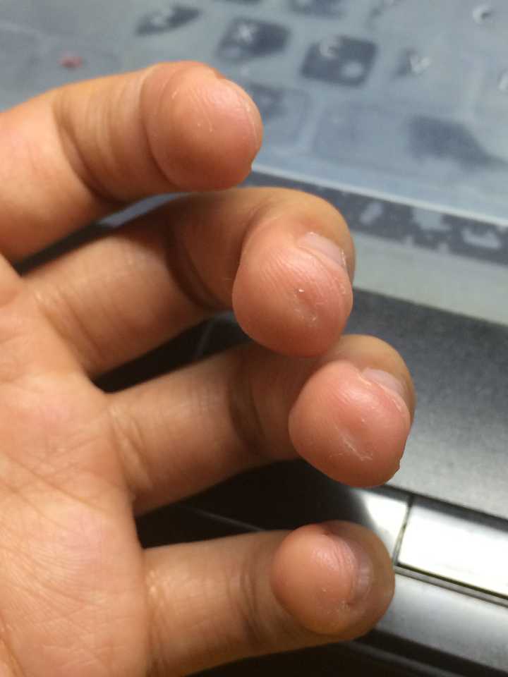 吉他手的指尖是不是都破皮破到很难看?