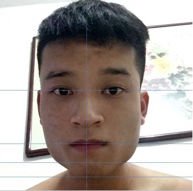 去医院医生说建议打瘦脸针不用削骨?