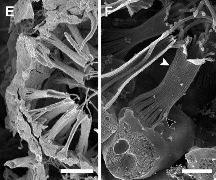 海绵的领细胞和领鞭毛虫在结构和功能上有什么区别