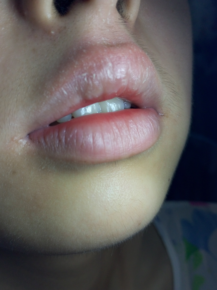 初期上嘴唇边缘会发硬,摸起来很不光滑,颗粒感很严重.