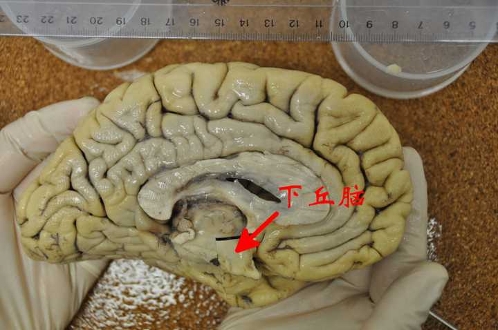 人们可以从死后的大脑切片中提取生前的信息吗,此类研究有哪些应用