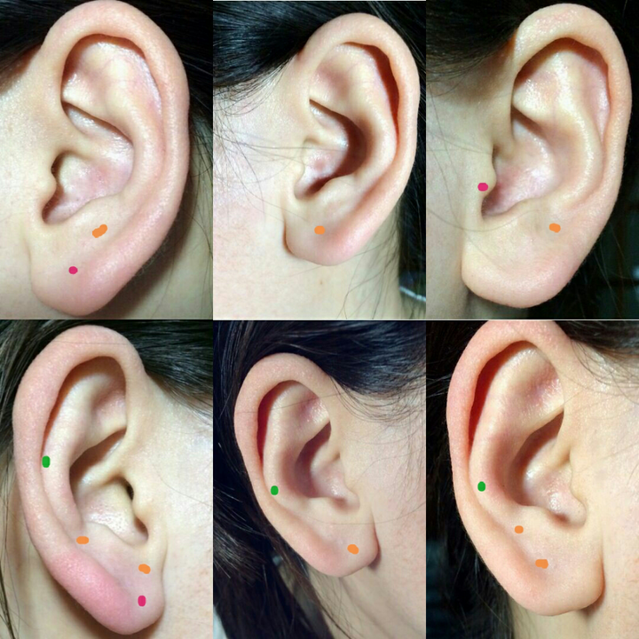 对于耳垂偏大,厚的人,应如何选择打耳洞的位置?