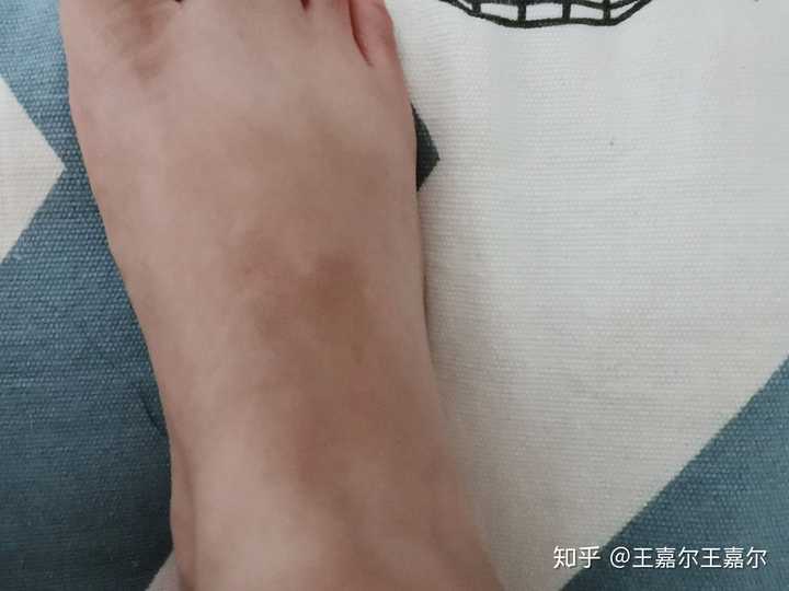 你们身上有什么样的胎记或印记,找找有缘人呐!