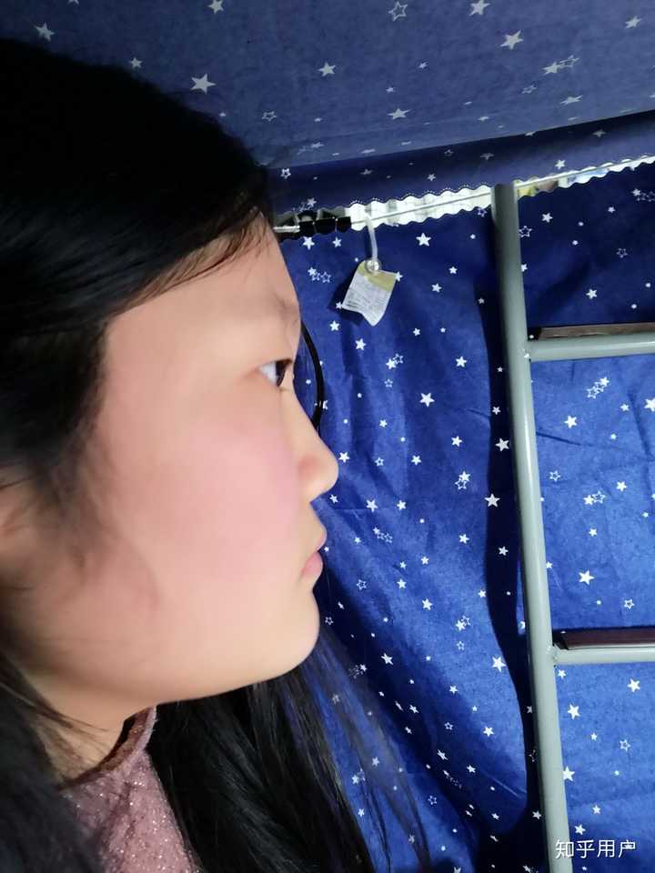 侧脸很平啊 怎么办啊 感觉脸就是一条线下去了 特别丑 眼睛近视还突