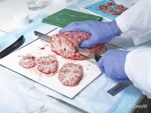 随后进行大脑切片,来研究大体解剖(gross anatomy)