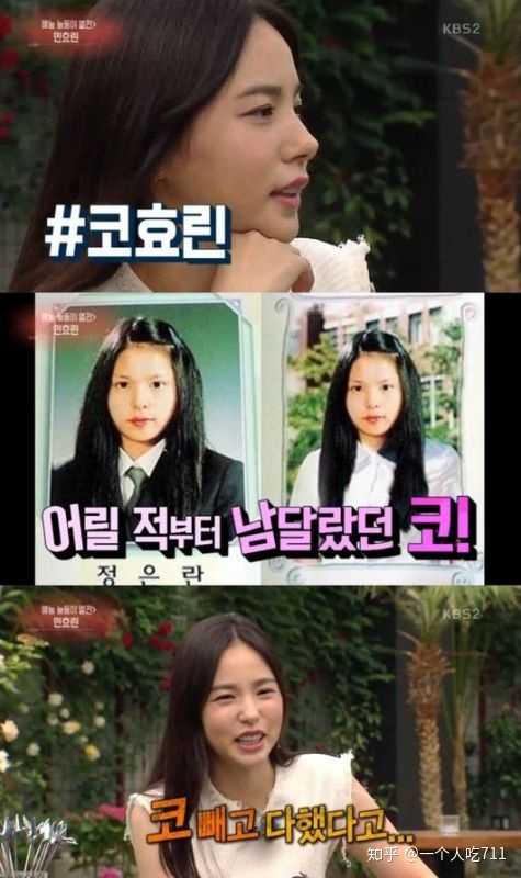 韩国有哪些明星做了明显的整容?