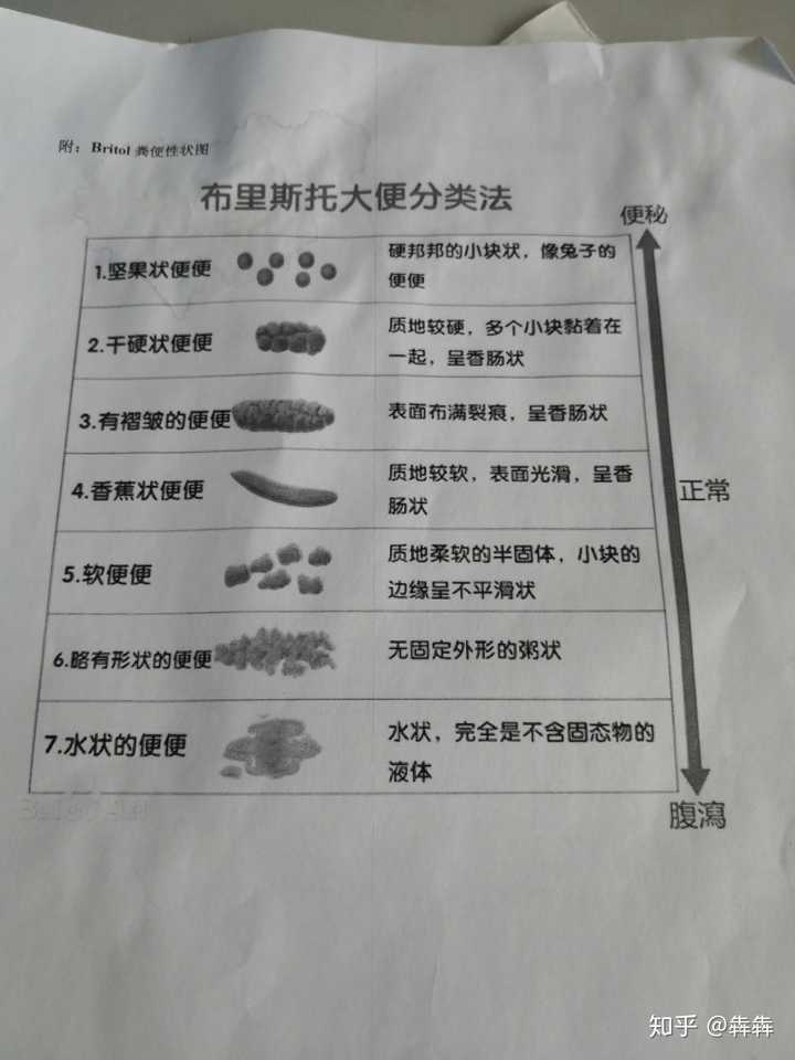 疼死我了,然后他说,嗯,没什么问题,有一点水肿,回去擦龙珠软膏