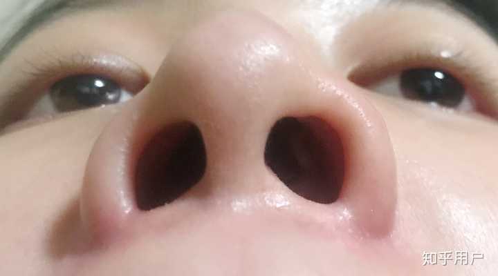 额 实在是不好意思我跑个题 我是看了高赞那个说王一博鼻子整了还留