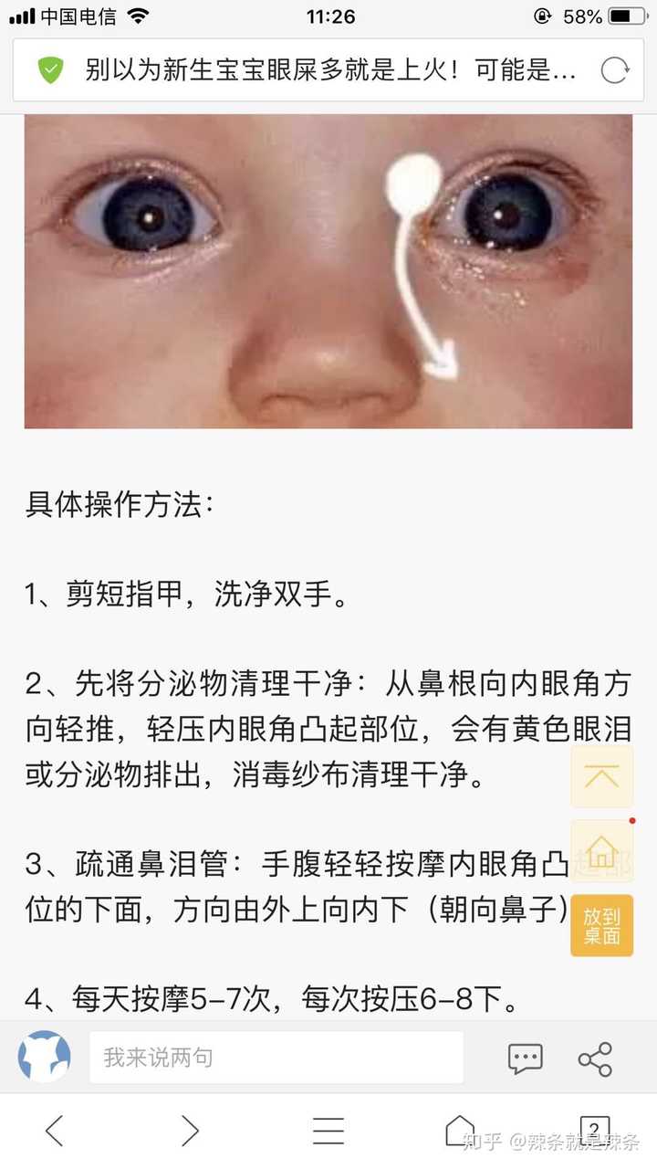 其余的小问题,比如鼻泪管堵塞啊(不哭的时候泪汪汪,或者黄色眼屎糊