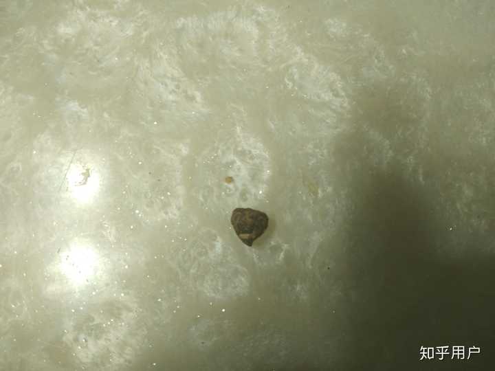 耳屎最大能有多大?