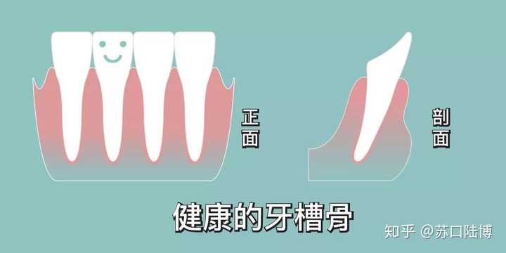 牙槽骨吸收的方式和程度,可通过x线片来观察.