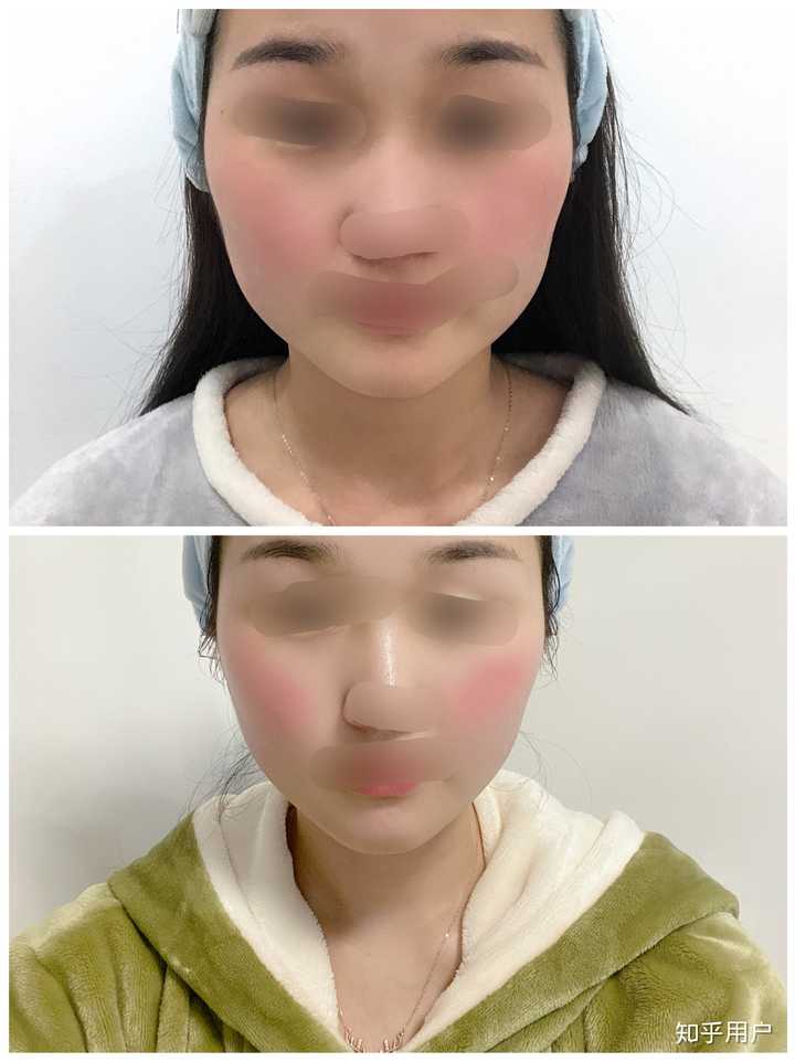 网上吹的一些瘦脸产品(按摩仪,面膜,瘦脸操……)真的有效吗?