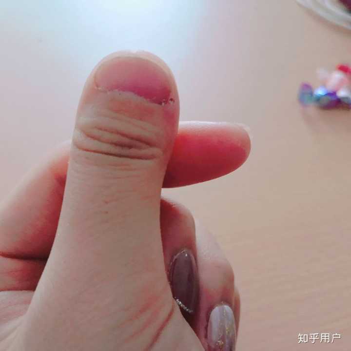 虽然拇指长得奇丑,但是其他的手指还算正常叭,但是我很难把指甲留长