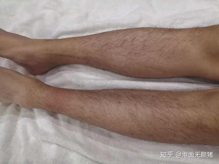 男生,很迷恋全身脱毛,这正常么?