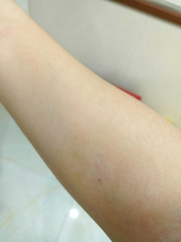 手上血管细输液扎针困难是一种什么体验?