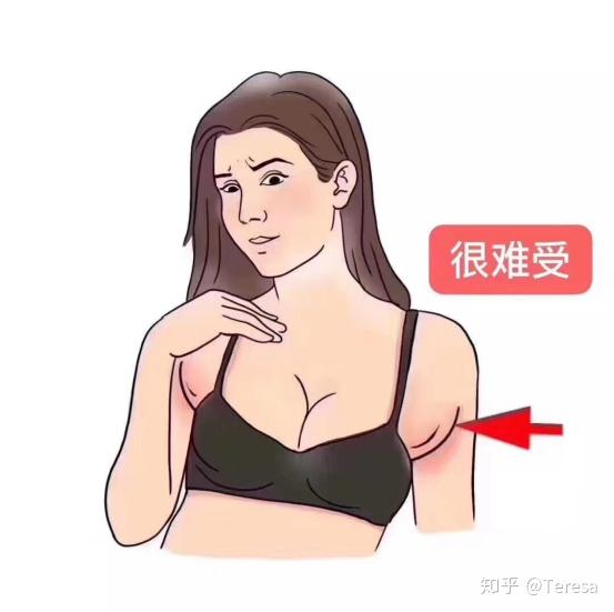 副乳