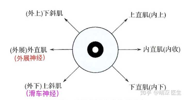 如何区分周围性眼肌麻痹与核间性眼肌麻痹?