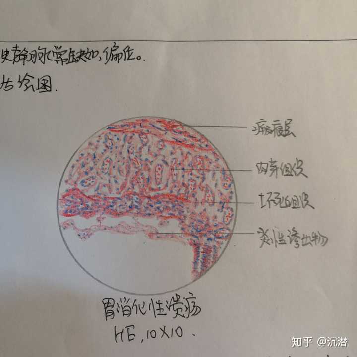 如何用红蓝铅笔画出好看的切片图?