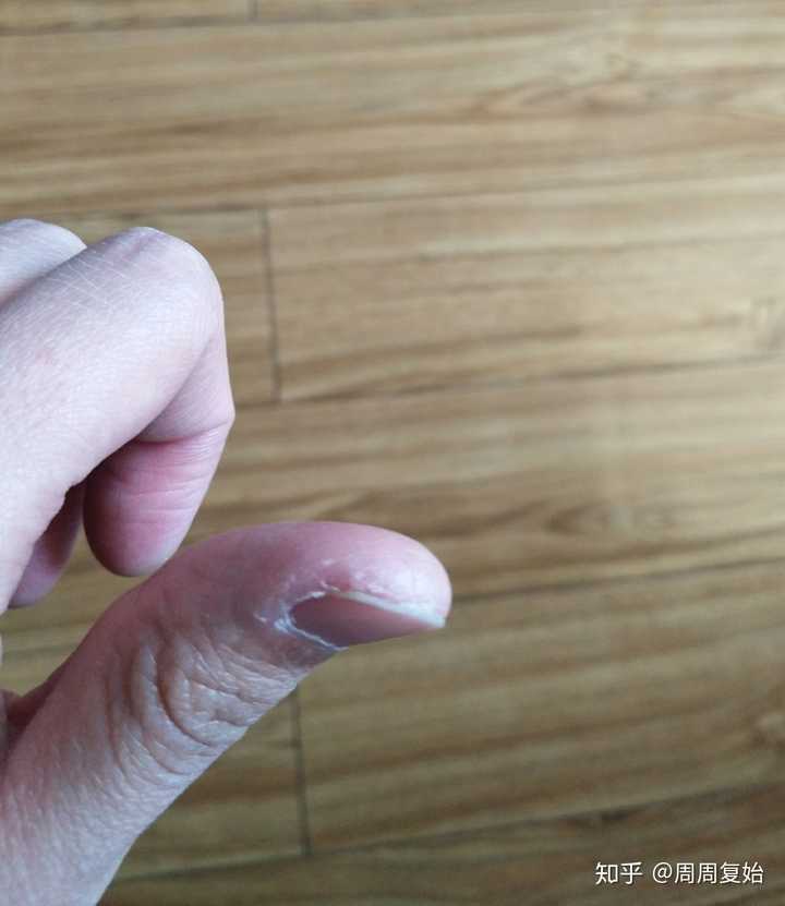 (刚拍的 可以勉强看出来之前抠的痕迹)