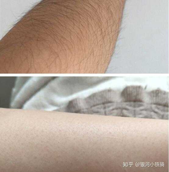 下面就来跟大家讲讲我和毛发的pk史. 一,剃毛刀vs毛发