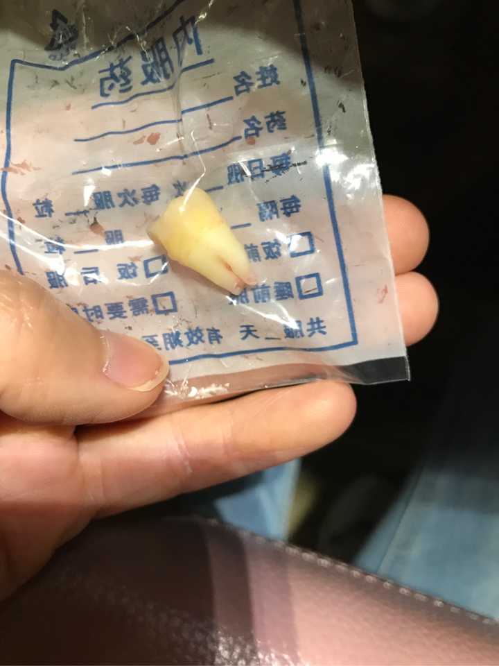 拔牙后的那窟窿会怎样,会长愈合吗?