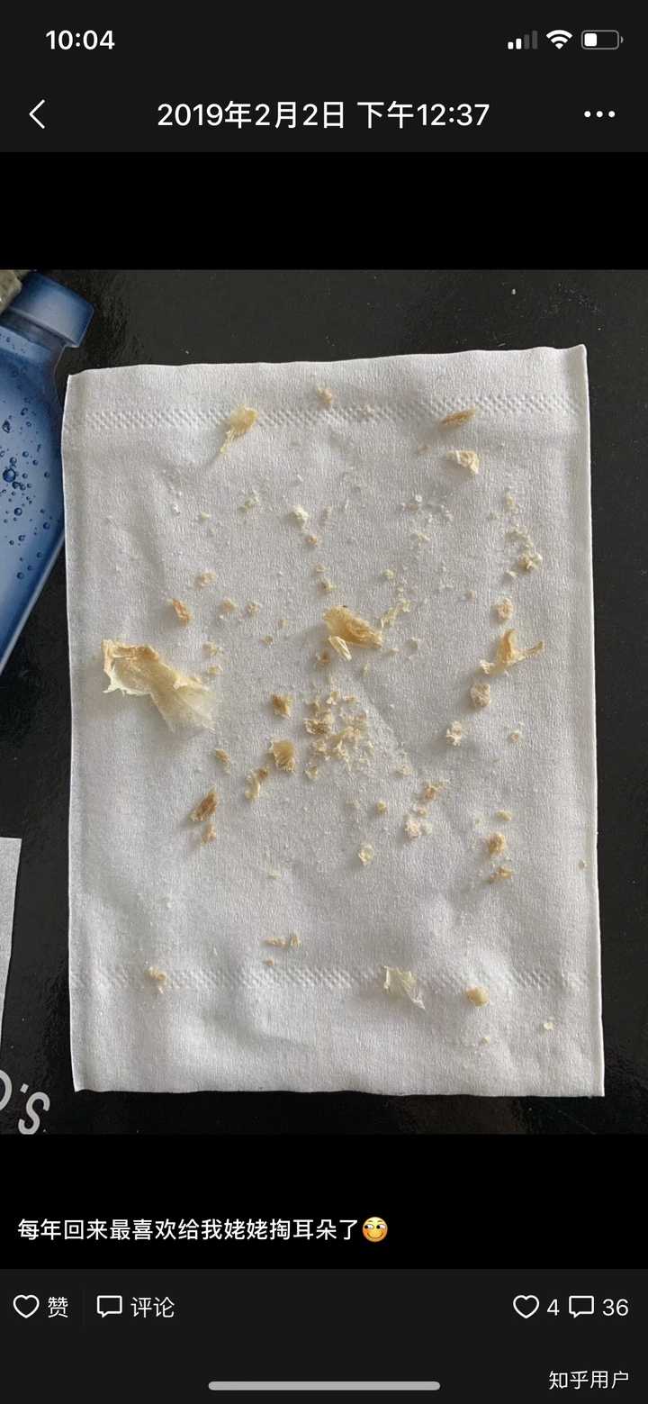 耳屎能大到什么程度?