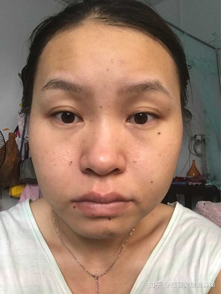 20岁出头,经常被认成三四十岁的大妈,以至于母胎单身到二十五六都没