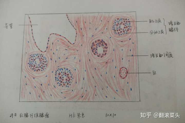 为什么咱们不弄个病理红蓝手绘图的问题呢?