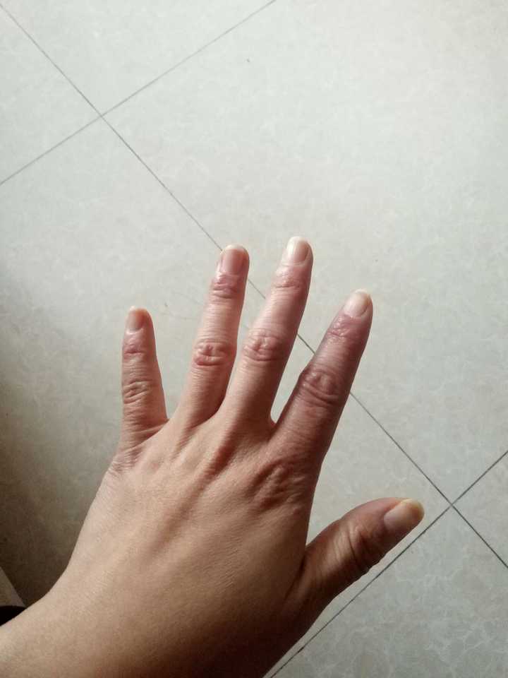 看看 这是一个二十岁的花季少女该有的手!