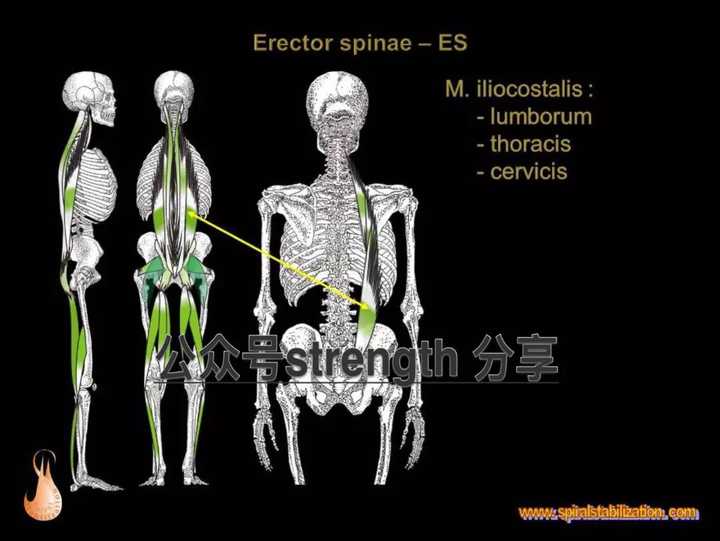 erector spinae(es)竖脊肌