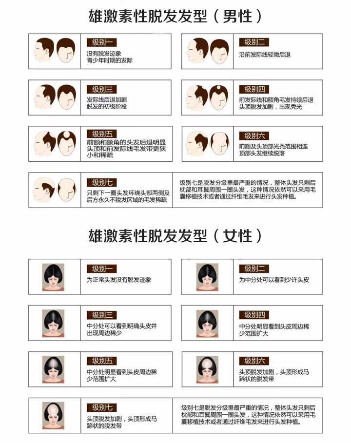 男性的雄激素性脱发又叫男性型脱发,女性的雄激素性脱发又叫女性型