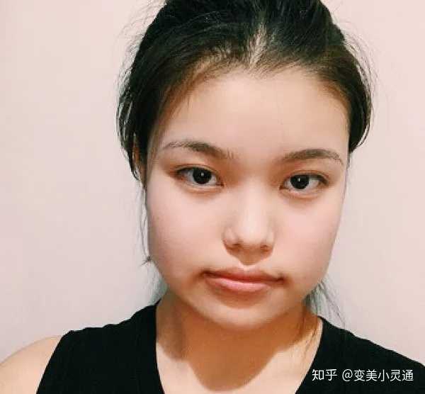 我这样的方脸削骨会好看吗?有削骨经历的姐妹可以分享