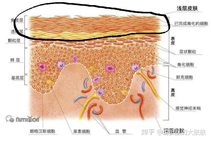 在这个时候,当鳞片状的角质细胞不能提供足够的张力,它将在内压的增大