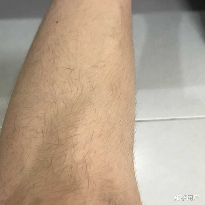 胳膊上汗毛太长怎么办?