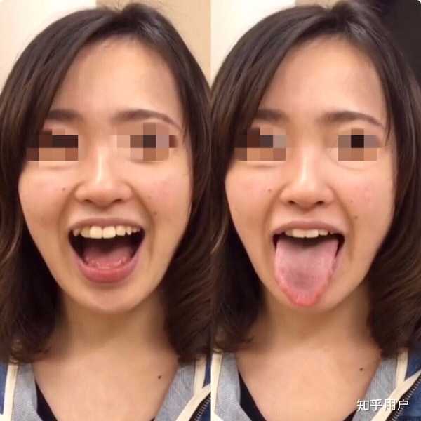 女生口臭是种怎样的体验?