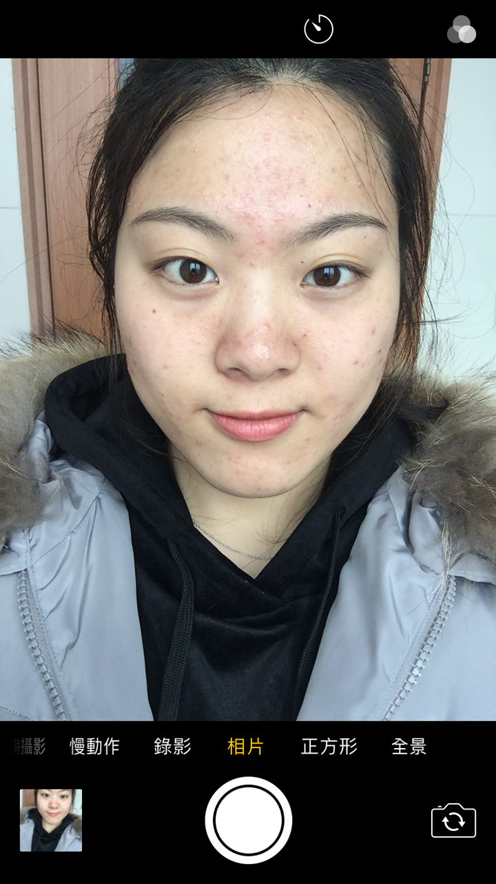 附一下我去年那张痘痘脸的照片