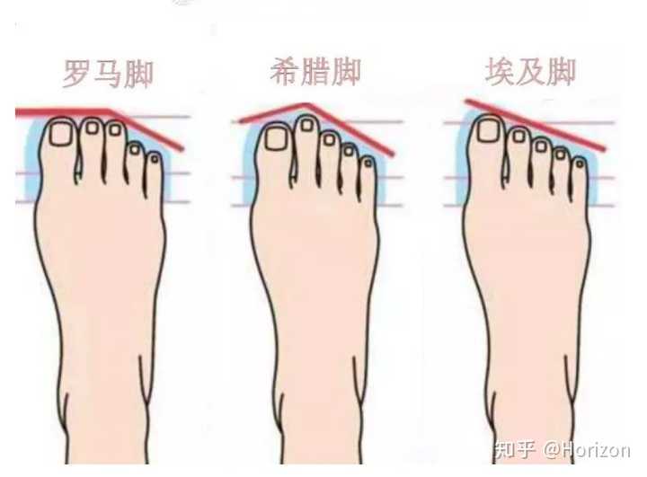 脚趾长度不同