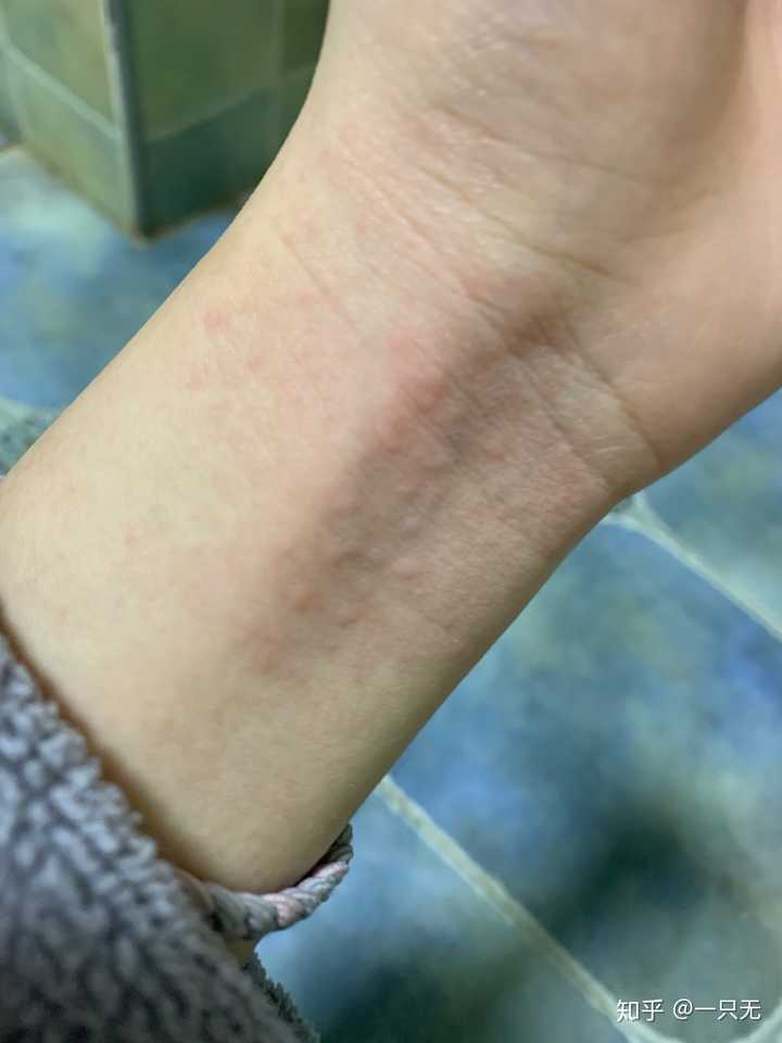 我酒精过敏 平时和朋友出去聚餐也是他们喝啤酒我和苦荞茶 颜色差不