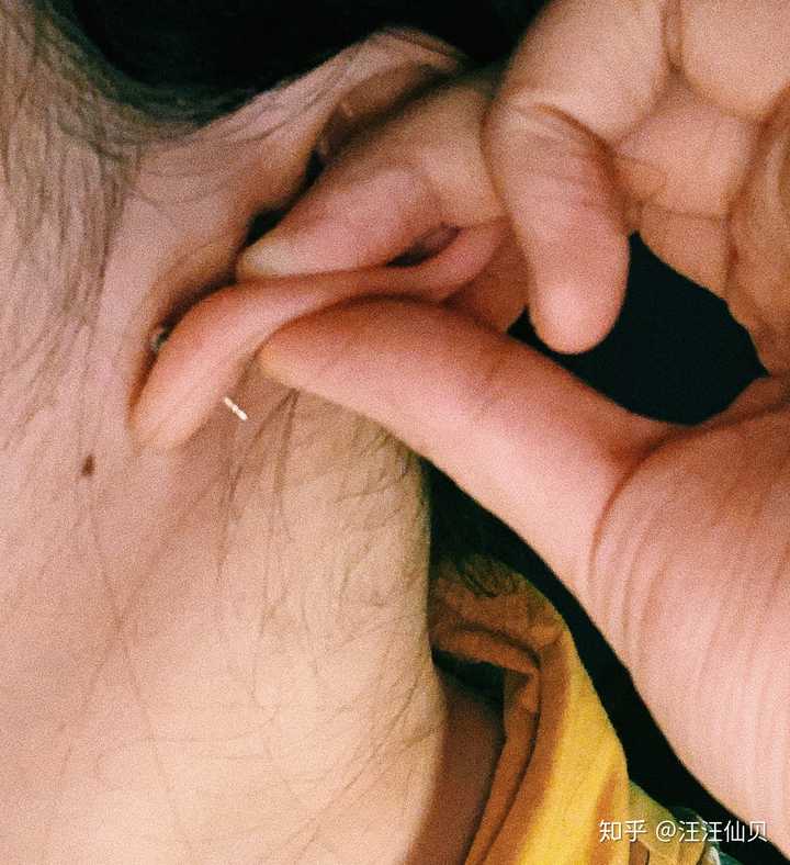 如何判断耳洞长好了?