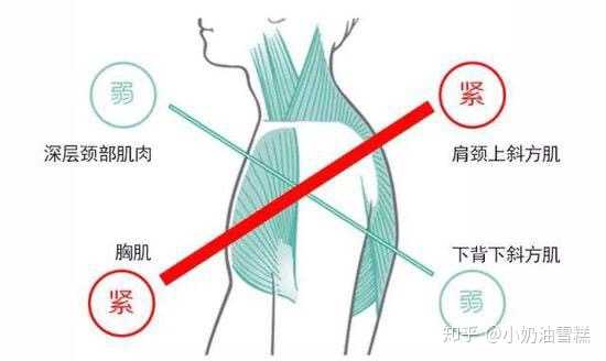 如何改善含胸(肩胛骨外翻)?