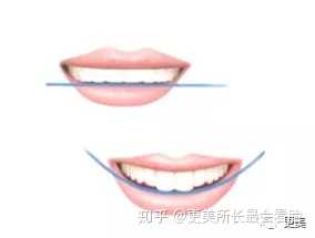 亚洲人对牙齿的审美标准是什么样的