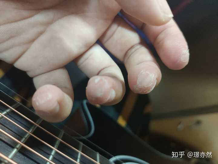 大家弹吉他的手指都是什么样的?