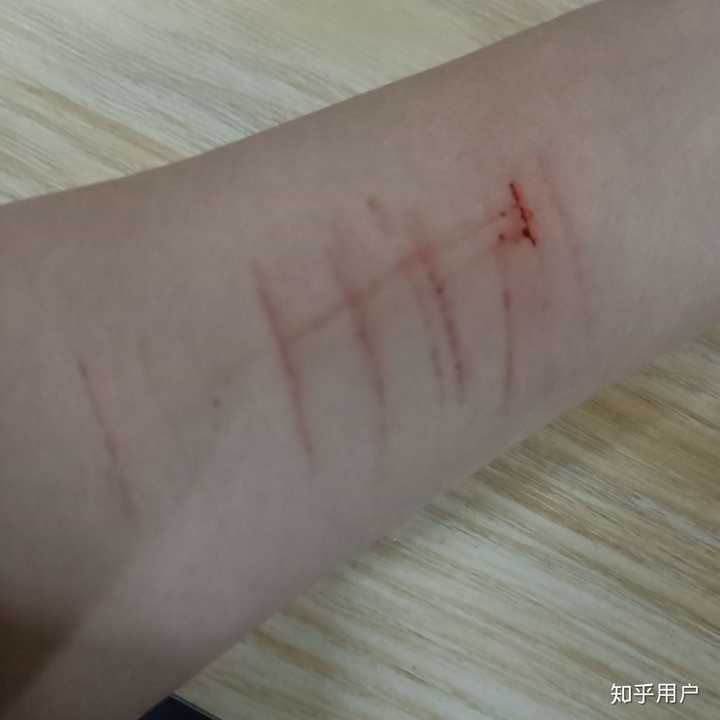 自残属于什么心理?