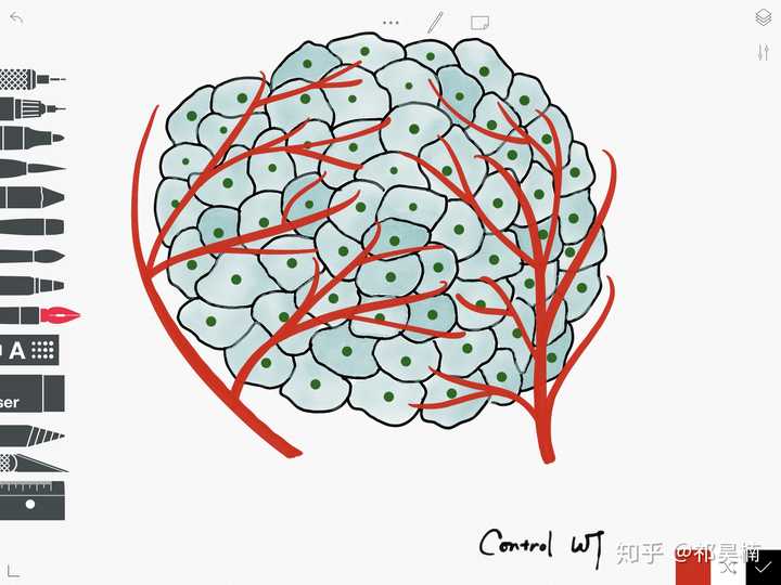 对照组肿瘤里面血管密布大量新生血管